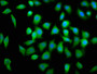 Immunofluorescence staining of A549 cells with CAC07416 at 1:100, counter-stained with DAPI. The cells were fixed in 4% formaldehyde, permeabilized using 0.2% Triton X-100 and blocked in 10% normal Goat Serum. The cells were then incubated with the antibody overnight at 4°C. The secondary antibody was Alexa Fluor 488-congugated AffiniPure Goat Anti-Rabbit IgG(H+L).