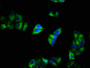 Immunofluorescence staining of Hela cells with CAC07418 at 1:200, counter-stained with DAPI. The cells were fixed in 4% formaldehyde, permeabilized using 0.2% Triton X-100 and blocked in 10% normal Goat Serum. The cells were then incubated with the antibody overnight at 4°C. The secondary antibody was Alexa Fluor 488-congugated AffiniPure Goat Anti-Rabbit IgG(H+L).