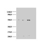Western blot; All lanes: AP2M1 antibody at 2µg/ml; Lane 1: Jurket whole cell lysate; Lane 2: U87 whole cell lysate; Lane 3: U251 whole cell lysate; Secondary; Goat polyclonal to rabbit IgG at 1/15000 dilution; Predicted band size: 50 kDa; Observed band size: 50, 22 kDa