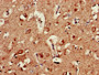Immunohistochemistry of paraffin-embedded human brain tissue using CAC07420 at dilution of 1:100