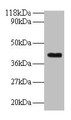 Western blot; All lanes: ELAVL2 antibody at 2µg/ml + Mouse brain tissue; Secondary; Goat polyclonal to rabbit IgG at 1/10000 dilution; Predicted band size: 40, 39 kDa; Observed band size: 40 kDa