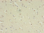 Immunohistochemistry of paraffin-embedded human brain tissue using CAC07423 at dilution of 1:100