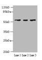 Western blot; All lanes: IFIT5 antibody at 2µg/ml; Lane 1: A375 whole cell lysate; Lane 2: Jurkat whole cell lysate; Lane 3: HepG2 whole cell lysate; Secondary; Goat polyclonal to rabbit IgG at 1/10000 dilution; Predicted band size: 56, 51 kDa; Observed band size: 56 kDa