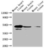 Western blot; All lanes: Selenoprotein P antibody at 2µg/ml + Mouse heart tissue; Secondary; Goat polyclonal to rabbit IgG at 1/10000 dilution; Predicted band size: 43 kDa; Observed band size: 43 kDa;