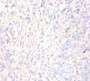 Immunohistochemistry of paraffin-embedded human gastric cancer using CAC07448 at dilution of 1:50