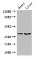 Western Blot; ,Positive WB detected in: Mouse heart tissue, Mouse liver tissue; ,All lanes: CTSB antibody at 3µg/ml; ,Secondary; ,Goat polyclonal to rabbit IgG at 1/50000 dilution; ,Predicted band size: 38 kDa; ,Observed band size: 38 kDa