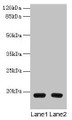 Western blot; All lanes: PDE6D antibody at 1.5µg/ml; Lane 1: A549 whole cell lysate; Lane 2: MCF-7 whole cell lysate; Secondary; Goat polyclonal to rabbit IgG at 1/10000 dilution; Predicted band size: 18 kDa; Observed band size: 18 kDa
