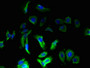 Immunofluorescence staining of MCF-7 cells with CAC07467 at 1:133, counter-stained with DAPI. The cells were fixed in 4% formaldehyde, permeabilized using 0.2% Triton X-100 and blocked in 10% normal Goat Serum. The cells were then incubated with the antibody overnight at 4°C. The secondary antibody was Alexa Fluor 488-congugated AffiniPure Goat Anti-Rabbit IgG(H+L).