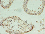 Immunohistochemistry of paraffin-embedded human testis tissue using CAC07471 at dilution of 1:100