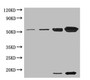 Western blot; All lanes: Ribulose-1,5-bisphosphate carboxylase oxygenase antibody at 5µg/ml; Lane 1: Ribulose-1,5-bisphosphate carboxylase oxygenase at 0.01µg/ml; Lane 2: Ribulose-1,5-bisphosphate carboxylase oxygenase at 0.1µg/ml; Lane 3: Ribulose-1,5-bisphosphate carboxylase oxygenase at 1µg/ml; Lane 4: Ribulose-1,5-bisphosphate carboxylase oxygenase at 10µg/ml; Secondary; Goat polyclonal to rabbit IgG at 1/15000 dilution; Predicted band size: 55, 14 kDa; Observed band size: 55, 14 kDa