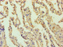 Immunohistochemistry of paraffin-embedded human lung tissue using CAC07487 at dilution of 1:100