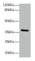 Western blot; All lanes: BRCC3 antibody at 2µg/ml + K562 whole cell lysate; Secondary; Goat polyclonal to rabbit IgG at 1/15000 dilution; Predicted band size: 37, 34, 24, 29 kDa; Observed band size: 37 kDa