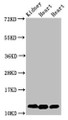 Western Blot; Positive WB detected in: Rat kidney tissue, Rat heart tissue, Mouse heart tissue; All lanes: CYCS antibody at 2µg/ml; Secondary; Goat polyclonal to rabbit IgG at 1/50000 dilution; Predicted band size: 12 kDa; Observed band size: 12 kDa