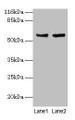 Western blot; All lanes: CYP17A1 antibody at 2µg/ml; Lane 1: Hela whole cell lysate; Lane 2: A549 whole cell lysate; Secondary; Goat polyclonal to rabbit IgG at 1/10000 dilution; Predicted band size: 58 kDa; Observed band size: 58 kDa