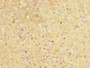 Immunohistochemistry of paraffin-embedded human adrenal gland tissue using CAC07498 at dilution of 1:100