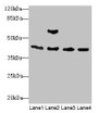 Western blot; All lanes: Acta1 antibody at 2µg/ml; Lane 1: Mouse brain tissue; Lane 2: Mouse lung tissue; Lane 3: Rat muscle tissue; Lane 4: Zebrafish lysate; Secondary; Goat polyclonal to rabbit IgG at 1/10000 dilution; Predicted band size: 43 kDa; Observed band size: 43 kDa