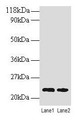 Western blot; All lanes: TAGLN antibody at 2µg/ml; Lane 1: EC109 whole cell lysate; Lane 2: 293T whole cell lysate; Secondary; Goat polyclonal to rabbit IgG at 1/15000 dilution; Predicted band size: 23 kDa; Observed band size: 23 kDa