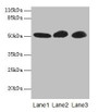 Western blot; All lanes: GDI2 antibody at 2µg/ml; Lane 1: Mouse brain tissue; Lane 2: HepG2 whole cell lysate; Lane 3: MCF-7 whole cell lysate; Secondary; Goat polyclonal to rabbit IgG at 1/10000 dilution; Predicted band size: 51, 46 kDa; Observed band size: 51 kDa