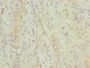 Immunohistochemistry of paraffin-embedded human liver cancer using CAC07536 at dilution of 1:100