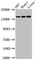 Western Blot; Positive WB detected in: U87 whole cell lysate, Rat heart tissue, Mouse liver tissue; All lanes: GRIN2A antibody at 3.2µg/ml; Secondary; Goat polyclonal to rabbit IgG at 1/50000 dilution; Predicted band size: 166, 145 kDa; Observed band size: 166 kDa