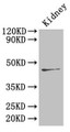 Western Blot; ,Positive WB detected in: Mouse kidney tissue; ,All lanes: Ren2 antibody at 4µg/ml; ,Secondary; ,Goat polyclonal to rabbit IgG at 1/50000 dilution; ,Predicted band size: 45 kDa; ,Observed band size: 45 kDa
