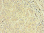 Immunohistochemistry of paraffin-embedded human liver cancer using CAC07565 at dilution of 1:100