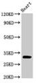 Western Blot; , Positive WB detected in: Rat heart tissue; , All lanes: PPP1R3B antibody at 2.5µg/ml; , Secondary; , Goat polyclonal to rabbit IgG at 1/50000 dilution; , Predicted band size: 33 kDa; , Observed band size: 33 kDa