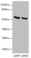 Western blot; All lanes: PNPLA2 antibody at 10µg/ml; Lane 1: Mouse liver tissue; Lane 2: NIH/3T3 whole cell lysate; Secondary; Goat polyclonal to rabbit IgG at 1/10000 dilution; Predicted band size: 56, 20 kDa; Observed band size: 56 kDa