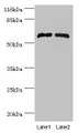 Western blot; All lanes: CYP4F11 antibody at 2µg/ml; Lane 1: Mouse liver tissue; Lane 2: Mouse kidney tissue; Secondary; Goat polyclonal to rabbit IgG at 1/10000 dilution; Predicted band size: 61 kDa; Observed band size: 61 kDa
