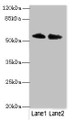 Western blot; All lanes: TRIM55 antibody at 1µg/ml; Lane 1: Hela whole cell lysate; Lane 2: Mouse liver tissue; Secondary; Goat polyclonal to rabbit IgG at 1/10000 dilution; Predicted band size: 61, 51, 27 kDa; Observed band size: 61 kDa;