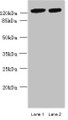 Western blot; All lanes: MCM9 antibody at 0.8µg/ml; Lane 1: Mouse brain tissue; Lane 2: 293T whole cell lysate; Secondary; Goat polyclonal to rabbit IgG at 1/10000 dilution; Predicted band size: 128, 73, 44, 85 kDa; Observed band size: 128 kDa;