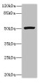 Western blot; All lanes: PORCN antibody at 3µg/ml + Mouse thymus tissue; Secondary; Goat polyclonal to rabbit IgG at 1/10000 dilution; Predicted band size: 53, 52, 43 kDa; Observed band size: 53 kDa