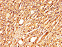 IHC image diluted at 1:300 and staining in paraffin-embedded human adrenal gland tissue performed on a Leica BondTM system. After dewaxing and hydration, antigen retrieval was mediated by high pressure in a citrate buffer (pH 6.0). Section was blocked with 10% normal goat serum 30min at RT. Then primary antibody (1% BSA) was incubated at 4°C overnight. The primary is detected by a biotinylated secondary antibody and visualized using an HRP conjugated SP system.