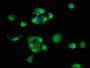 Immunofluorescence staining of MCF-7 cells with CAC07599 at 1:83, counter-stained with DAPI. The cells were fixed in 4% formaldehyde, permeabilized using 0.2% Triton X-100 and blocked in 10% normal Goat Serum. The cells were then incubated with the antibody overnight at 4°C. The secondary antibody was Alexa Fluor 488-congugated AffiniPure Goat Anti-Rabbit IgG(H+L).