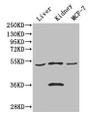 Western Blot; ,Positive WB detected in: Mouse liver tissue, Mouse kidney tissue, MCF-7 whole cell lysate; ,All lanes: CDSN antibody at 3µg/ml; ,Secondary; ,Goat polyclonal to rabbit IgG at 1/50000 dilution; ,Predicted band size: 52 kDa; ,Observed band size: 52, 36 kDa