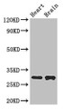 Western Blot; , Positive WB detected in: Mouse heart tissue, Mouse brain tissue; , All lanes: FCER1A antibody at 3µg/ml; , Secondary; , Goat polyclonal to rabbit IgG at 1/50000 dilution; , Predicted band size: 30 kDa; , Observed band size: 30 kDa;