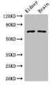 Western Blot; , Positive WB detected in: Mouse kidney tissue, Mouse brain tissue; , All lanes: GAA Antibody at 3µg/ml; , Secondary; , Goat polyclonal to rabbit IgG at 1/50000 dilution; , Predicted band size: 70, 76, 106 kDa; , Observed band size: 70 kDa;
