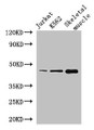 Western Blot; Positive WB detected in: Jurkat whole cell lysate, K562 whole cell lysate, Mouse skeletal muscle tissue; All lanes: MEIS1 antibody at 2.8µg/ml; Secondary; Goat polyclonal to rabbit IgG at 1/50000 dilution; Predicted band size: 44, 51 kDa; Observed band size: 44 kDa