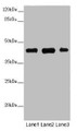 Western blot; All lanes: SS18L1 antibody at 2 µg/ml; Lane 1: Mouse kidney tissue; Lane 2: Mouse lung tissue; Lane 3: Mouse spleen tissue; Secondary; Goat polyclonal to rabbit IgG at 1/10000 dilution; Predicted band size: 43, 41, 34, 30, 44 kDa; Observed band size: 43 kDa;