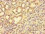 Immunohistochemistry of paraffin-embedded human gastric cancer using CAC07626 at dilution of 1:100