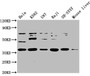 Western Blot; , Positive WB detected in: Hela whole cell lysate, K562 whole cell lysate, U87 whole cell lysate, Raji whole cell lysate, SH-SY5Y whole cell lysate, Mouse liver tissue; , All lanes: SS18L1 antibody at 1:2000; , Secondary; , Goat polyclonal to rabbit IgG at 1/50000 dilution; , Predicted band size: 43, 41, 34, 30, 44 kDa; , Observed band size: 43 kDa;