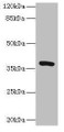 Western blot; All lanes: TMEM64 antibody at 8µg/ml + Mouse brain tissue; Secondary; Goat polyclonal to rabbit IgG at 1/10000 dilution; Predicted band size: 40, 13, 15, 34 kDa; Observed band size: 40 kDa