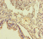 Immunohistochemistry of paraffin-embedded human lung tissue using CAC07629 at dilution of 1:100