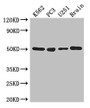 Western Blot; ,Positive WB detected in: K562 whole cell lysate, PC-3 whole cell lysate, U251 whole cell lysate, Mouse brain tissue; ,All lanes: TUBA1C antibody at 3µg/ml; ,Secondary; ,Goat polyclonal to rabbit IgG at 1/50000 dilution; ,Predicted band size: 50 kDa; ,Observed band size: 50 kDa