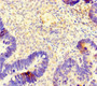 Immunohistochemistry of paraffin-embedded human ovarian cancer using CAC07632 at dilution of 1:100