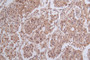 Immunohistochemistry of paraffin-embedded human ovarian cancer using CAC07636 at dilution of 1:100