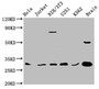 Western Blot; , Positive WB detected in: Hela whole cell lysate, Jurkat whole cell lysate, NIH/3T3 whole cell lysate, U251 whole cell lysate, K562 whole cell lysate, Rat brain tissue; , All lanes: YWHAG antibody at 3.3µg/ml; , Secondary; , Goat polyclonal to rabbit IgG at 1/50000 dilution; , Predicted band size: 29 kDa; , Observed band size: 29 kDa;