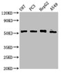 Western Blot; , Positive WB detected in: U87 whole cell lysate, PC-3 whole cell lysate, HepG2 whole cell lysate, A549 whole cell lysate; , All lanes: PPP2R2D antibody at 3.3µg/ml; , Secondary; , Goat polyclonal to rabbit IgG at 1/50000 dilution; , Predicted band size: 53 kDa; , Observed band size: 53 kDa;