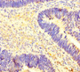 Immunohistochemistry of paraffin-embedded human ovarian cancer using CAC07657 at dilution of 1:100