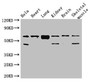 Western Blot; , Positive WB detected in: Hela whole cell lysate, Mouse heart tissue, Mouse lung tissue, Mouse kidney tissue, Mouse brain tissue, Mouse skeletal muscle tissue; , All lanes: PRKAA2 antibody at 2.7µg/ml; , Secondary; , Goat polyclonal to rabbit IgG at 1/50000 dilution; , Predicted band size: 63 kDa; , Observed band size: 63, 48 kDa;